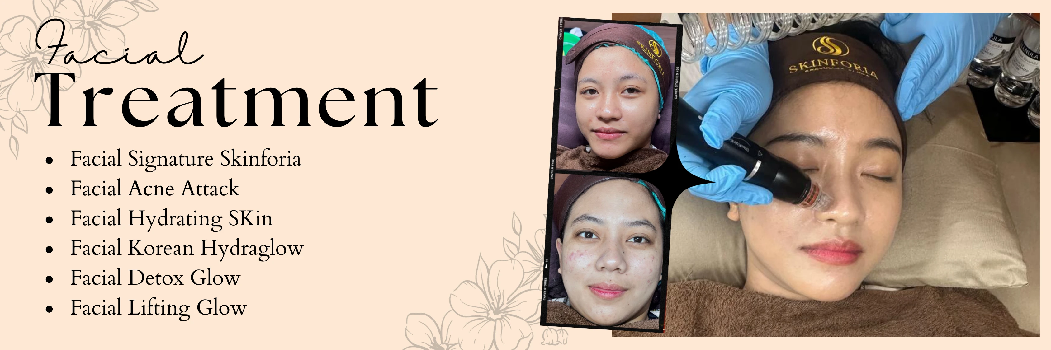 banner-treatment