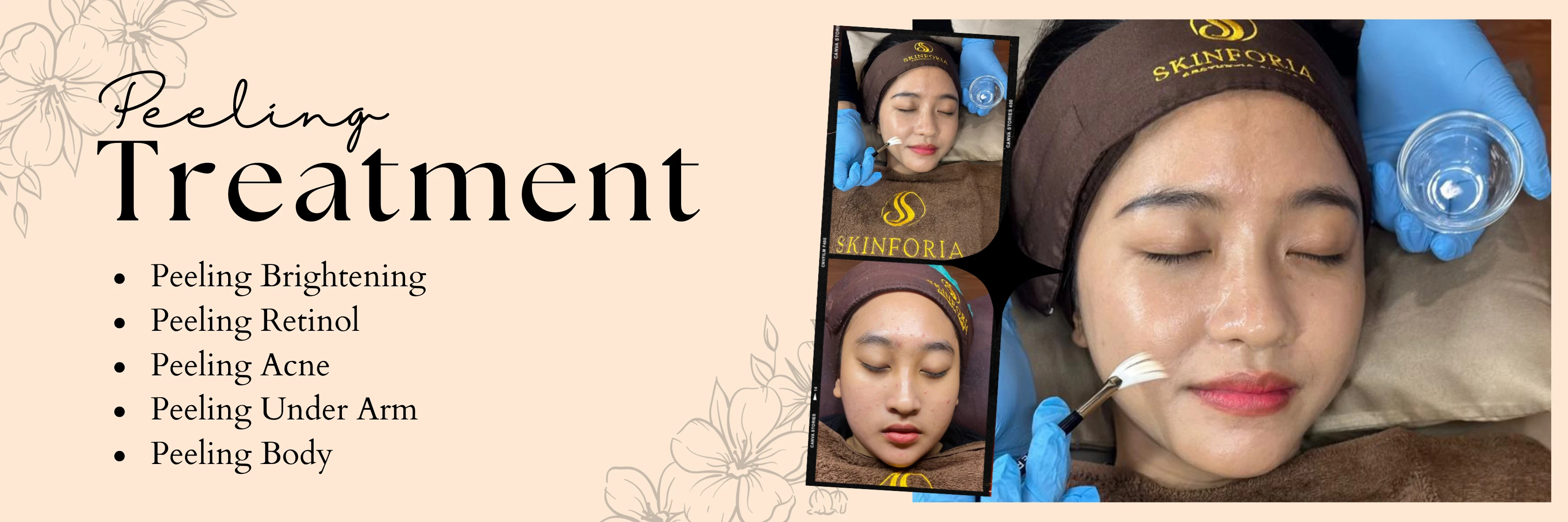 banner-treatment