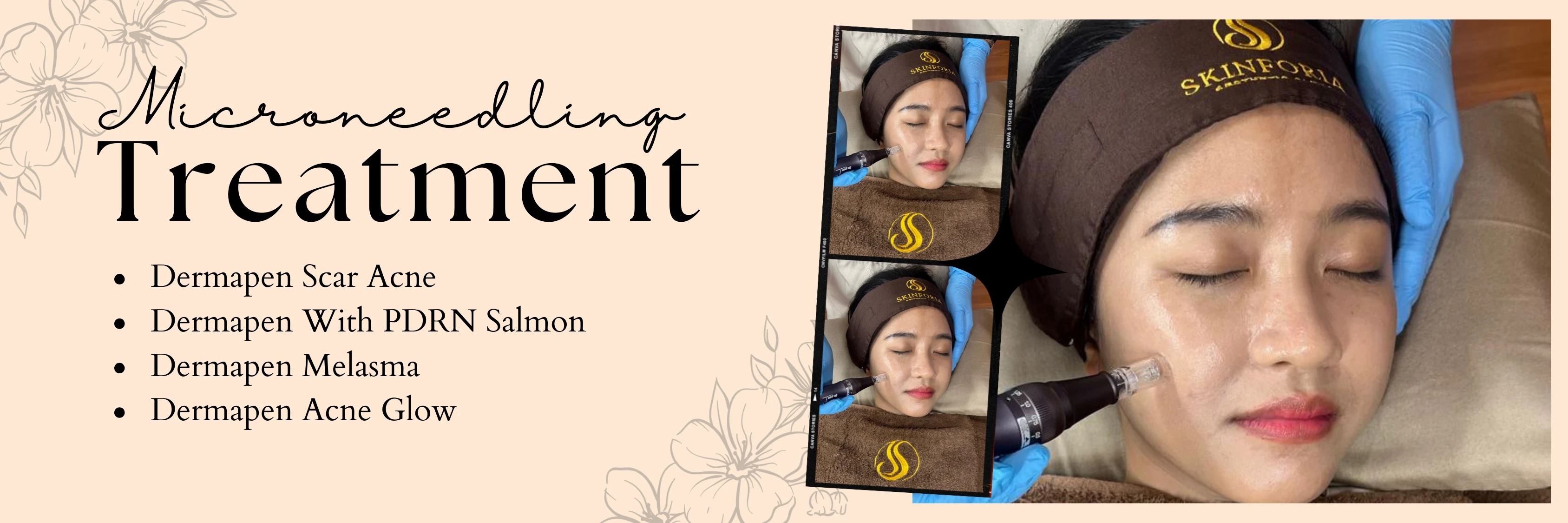 banner-treatment