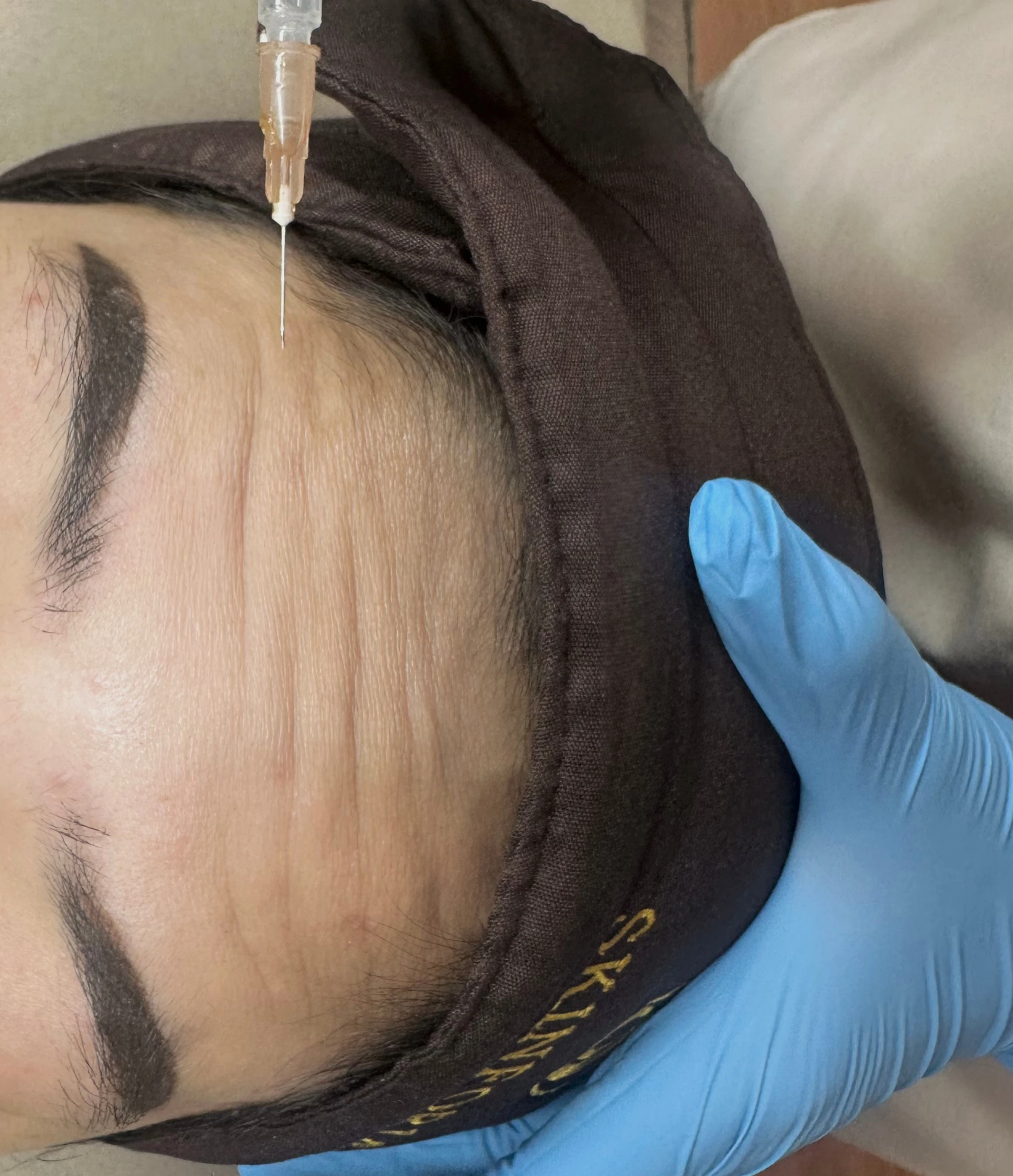 Botox